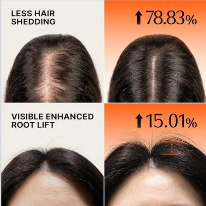 Volumizing Hair Growth Shampoo – 200ml coslora