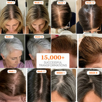 GrowTurn Hair Growth Serum