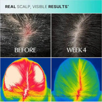 GrowTurn Hair Growth Serum